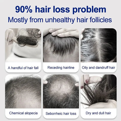 Follicle Restoration Red Light Therapy Cap